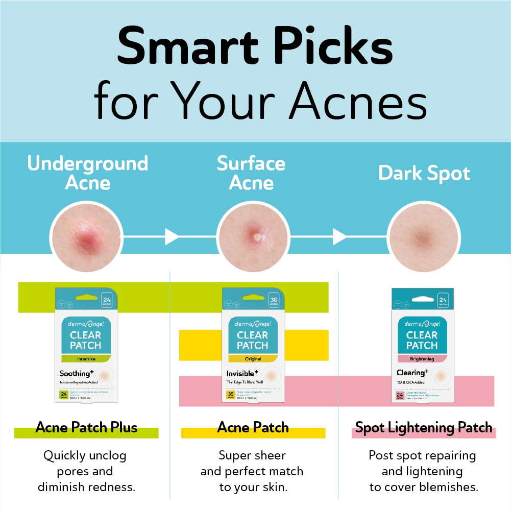 Invisible Salicylic Acid Pimple Patches – Hydrocolloid Acne & Zit Spot Stickers for Face, 2 Sizes (132 Count)