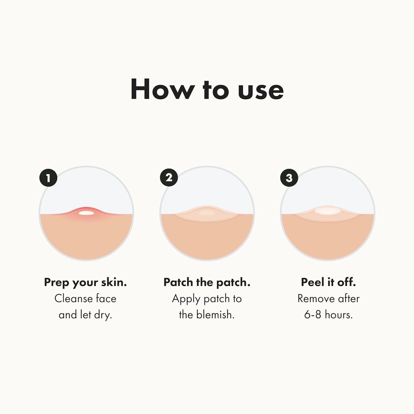 Hydrocolloid Acne Pimple Patches – Overnight Spot Stickers for Zits & Whiteheads (72 Count)