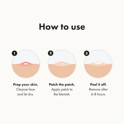 Hydrocolloid Acne Pimple Patches – Overnight Spot Stickers for Zits & Whiteheads (72 Count)