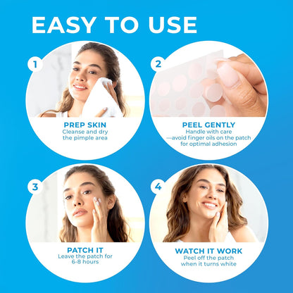 Hydrocolloid Pimple Patches for Face – Acne Spot Stickers with Tea Tree Oil (500 Patches)